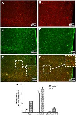 The Inhibitory Effects of Nesfatin-1 in Ventromedial Hypothalamus on Gastric Function and Its Regulation by Nucleus Accumbens